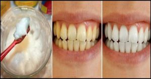 3 минуты процесса, может обеспечить ослепительные белые зубы естественным способом!