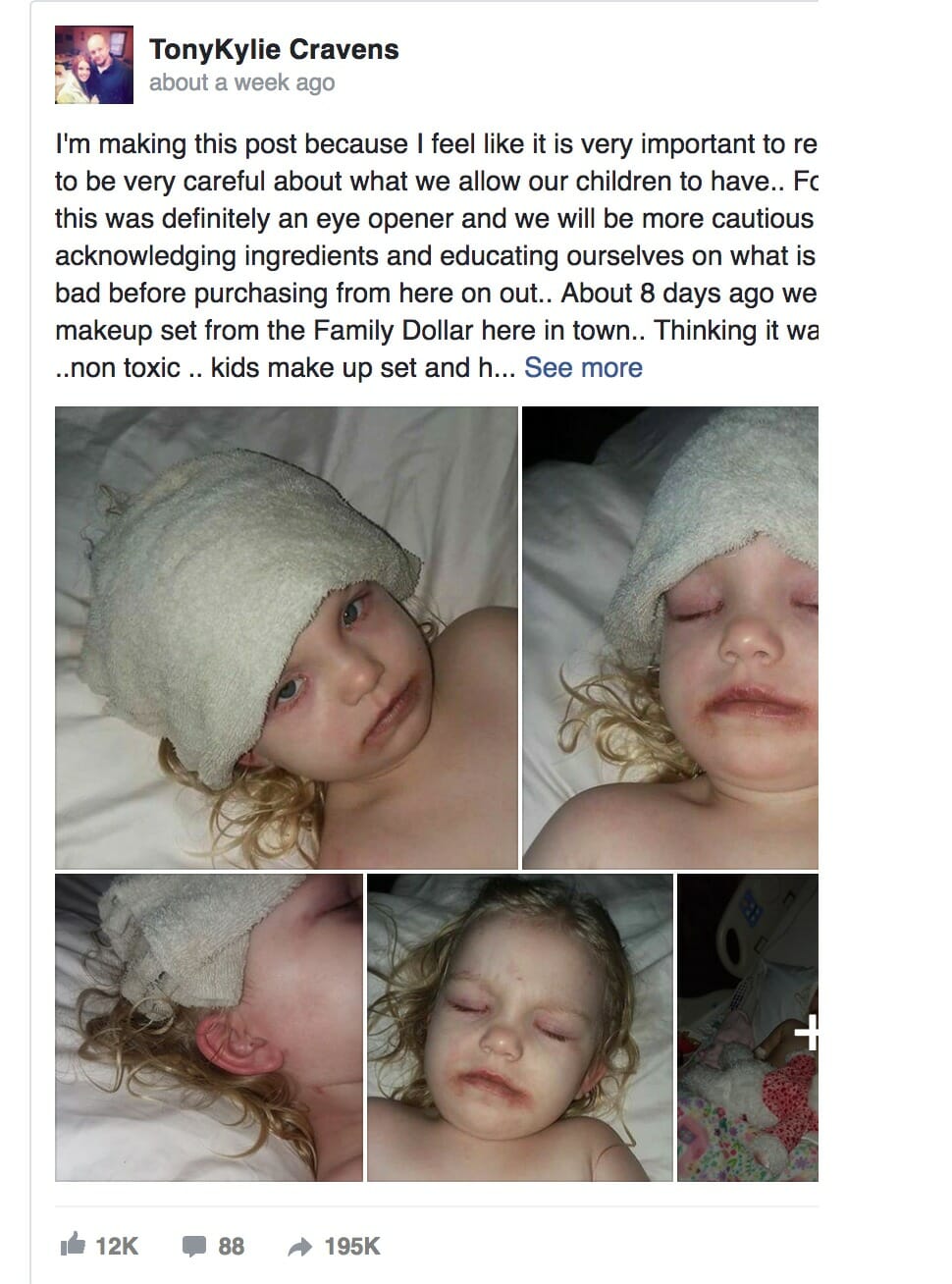 Ее маленькая дочка попала в больницу с ранами. И всё из-за покупки модной игрушки!