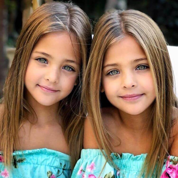 В 7 лет их назвали самыми красивыми близнецами в мире. Вот как они выглядят сейчас