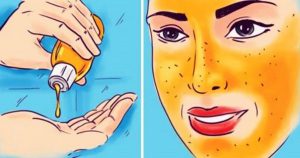 9 натуральных средств для кожи лица, которые убирают морщины и пятна